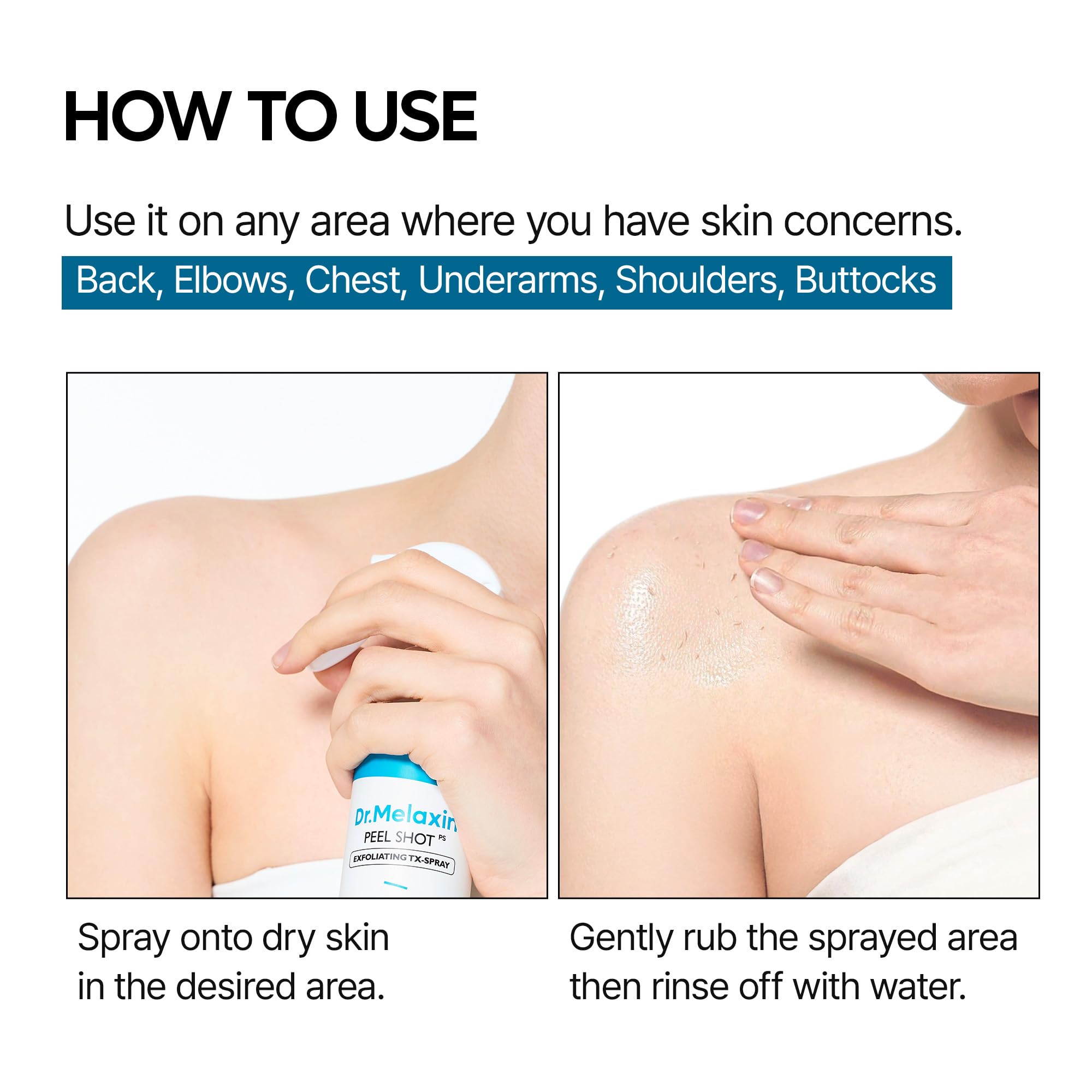 Dr.Melaxin Peel Shot Kojic Acid Turmeric Body Exfoliator Spray 6.76 fl.oz - AHA PHA Niacinamide Body Scrub for KP Bumps, Dark Spots, Uneven Skin Tone, Dead Skin, Korean Skin Care